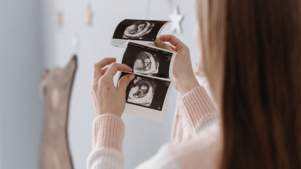 Women looking at baby scans thinking about future fertility treatment and preserving fertility